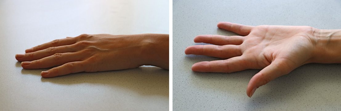 Fig.: Ideal – No jewelry or nail polish, fingernails end at the fingertip 