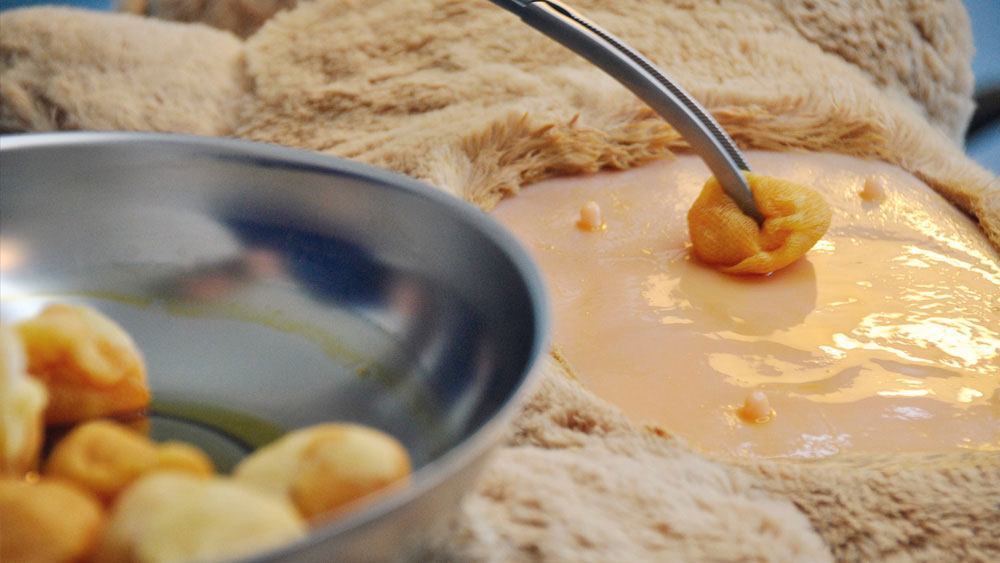 Application of an alcohol based PVP iodine skin preparation with Braunoderm® to a shaved surgical site on an animal using a swab as part of preoperative antisepsis in a veterinary setting.