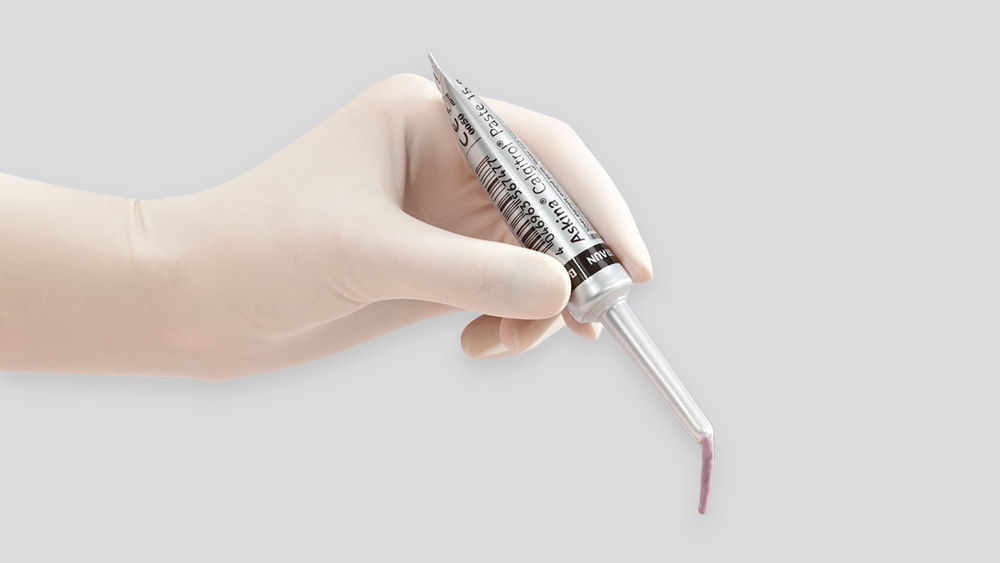 Askina® Calgitrol® Paste in use.