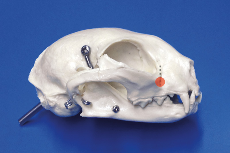 Infraorbital Nerve Block In the case of the skull, foramina permit the passage of arteries, veins and nerves. infraorbital nerve block