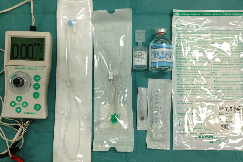 Peripheral Nerve Block