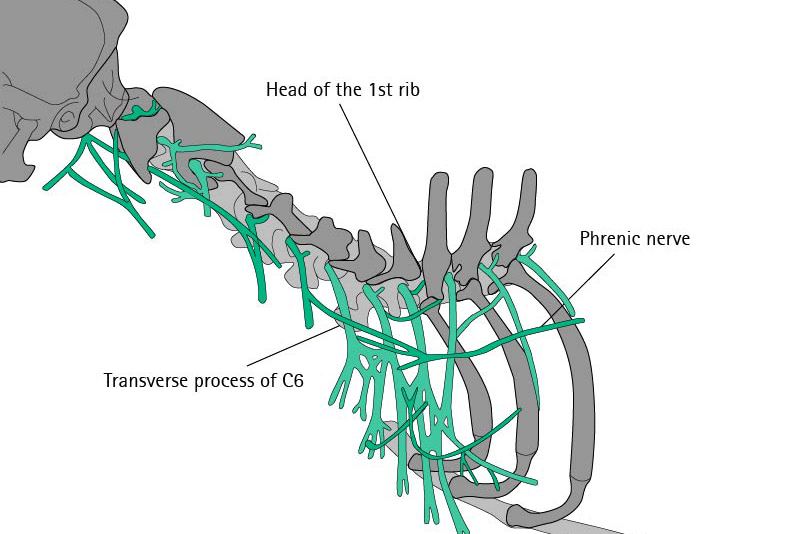 Canine Brachial Plexus